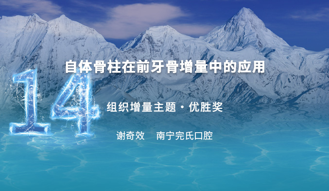 自体骨柱在前牙骨增量中的应用