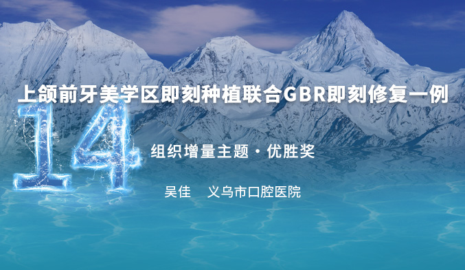 上颌前牙美学区即刻种植联合GBR即刻修复一例