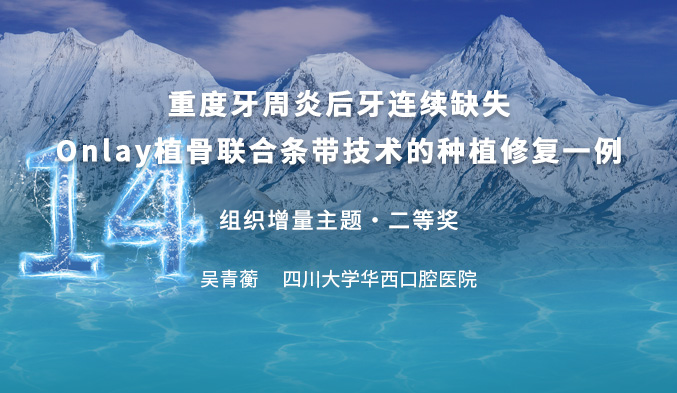 重度牙周炎后牙连续缺失Onlay植骨联合条带技术的种植修复一例