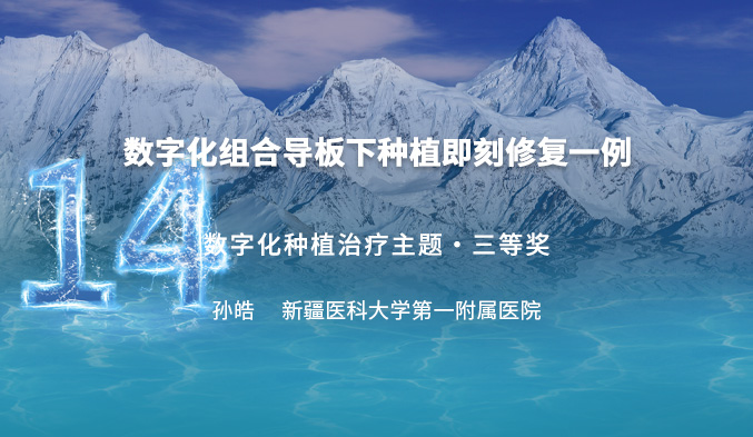 数字化组合导板下种植即刻修复一例