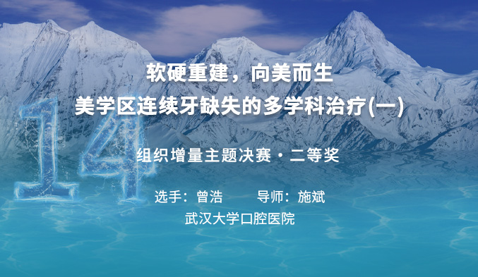 软硬重建，向美而生--美学区连续牙缺失的多学科治疗（一）