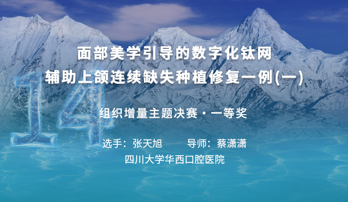 面部美学引导的数字化钛网辅助上颌连续缺失种植修复1例（一）