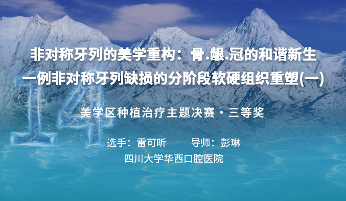 非对称牙列的美学重构：骨.龈.冠的和谐新生 —— 一例非对称牙列缺损的分阶段软硬组织重塑（一）