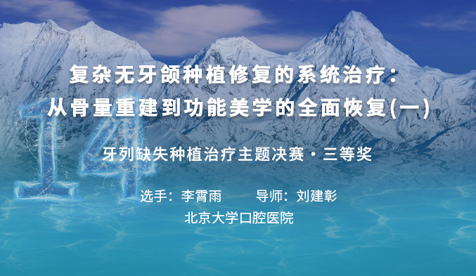 复杂无牙颌种植修复的系统治疗：从骨量重建到功能美学的全面恢复（一）